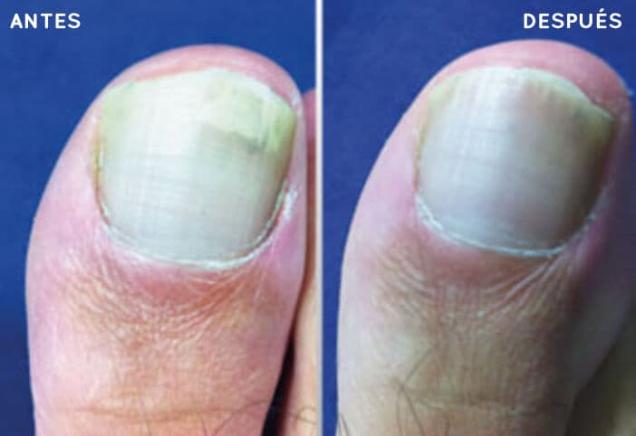 Antes y después de nuestros tratamientos