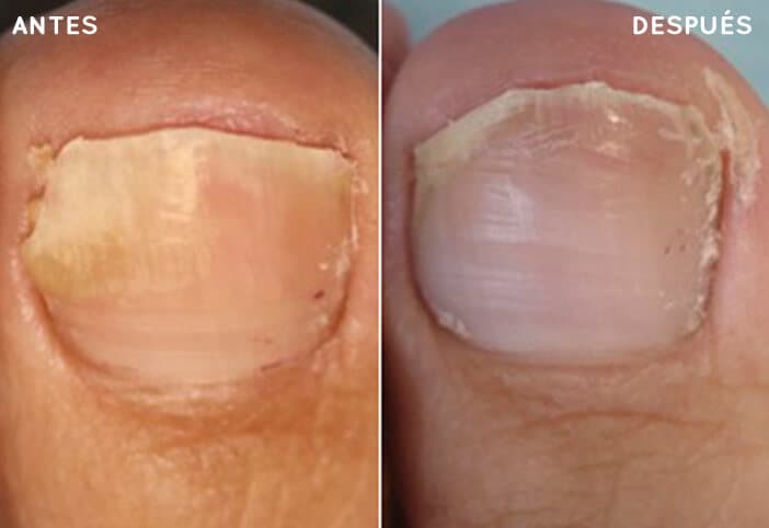 Antes y después de nuestros tratamientos
