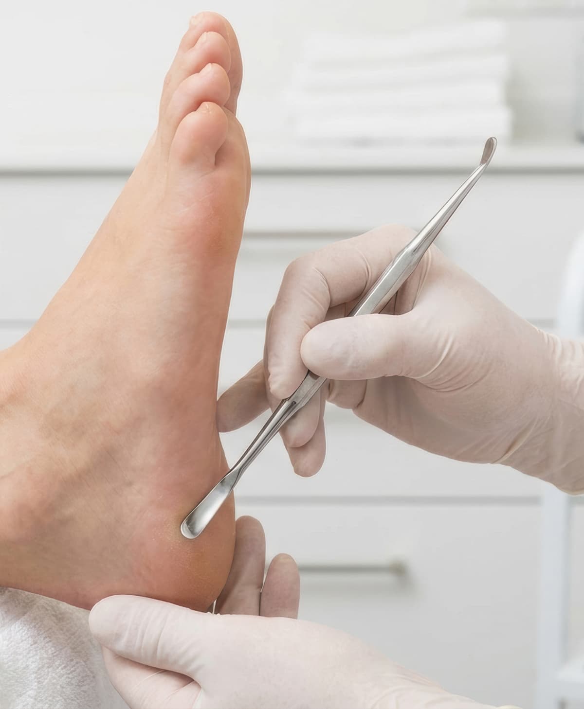 Consulta de quiropodia paso a paso en Santiago de Compostela